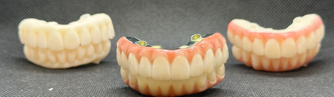 FC – Dental Implants at Buena Vida Dental Studio in Tucson AZ